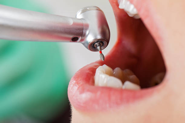 Best Pediatric Emergency Dentist in Delavan, IL